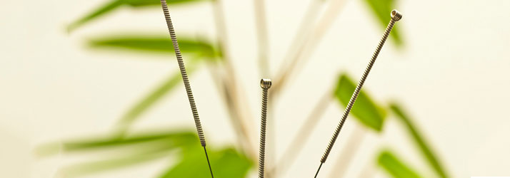 Chiropractic Sartell MN Needles Chiropractic Sartell MN Needles